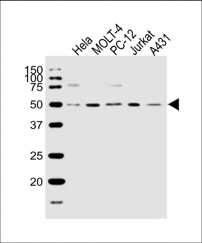 WB - GTF2E1 Antibody (N-term) AW5548-U100